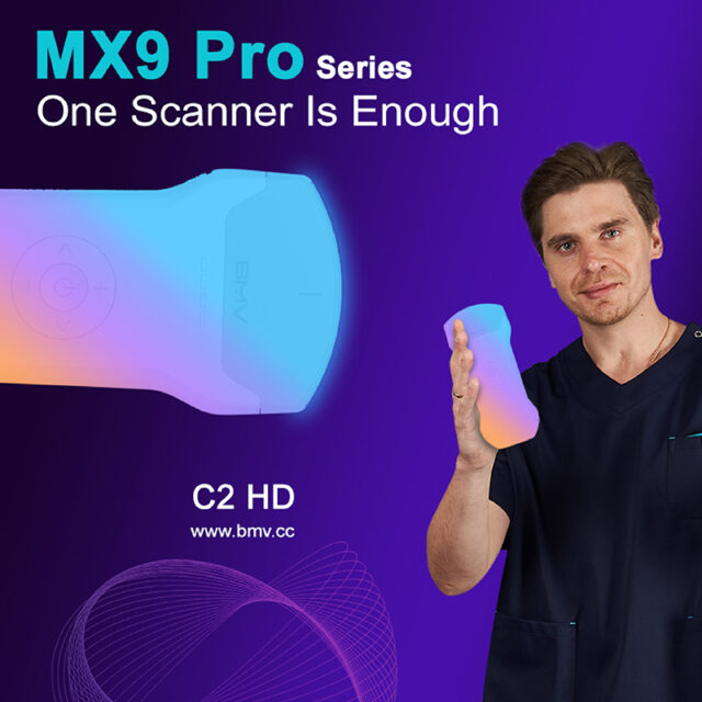 MX9 Pro C2 HD (Fifth Generation) 192 Elements Pocket Handheld Ultrasound Scanners